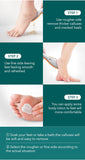 Pedicure Callus Dead Skin Remover - Beauty Relemay