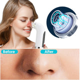 Pore Cleaner Vacuum Tool - Beauty Relemay